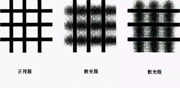 儿童散光会引起哪些问题,散光未来可不可能治好