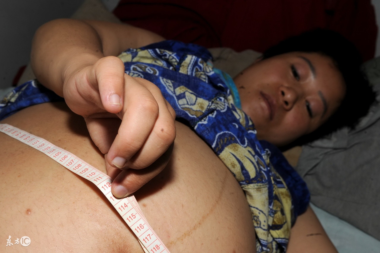 孕期一切正常但是一直流血,孕期流血不多没腹痛