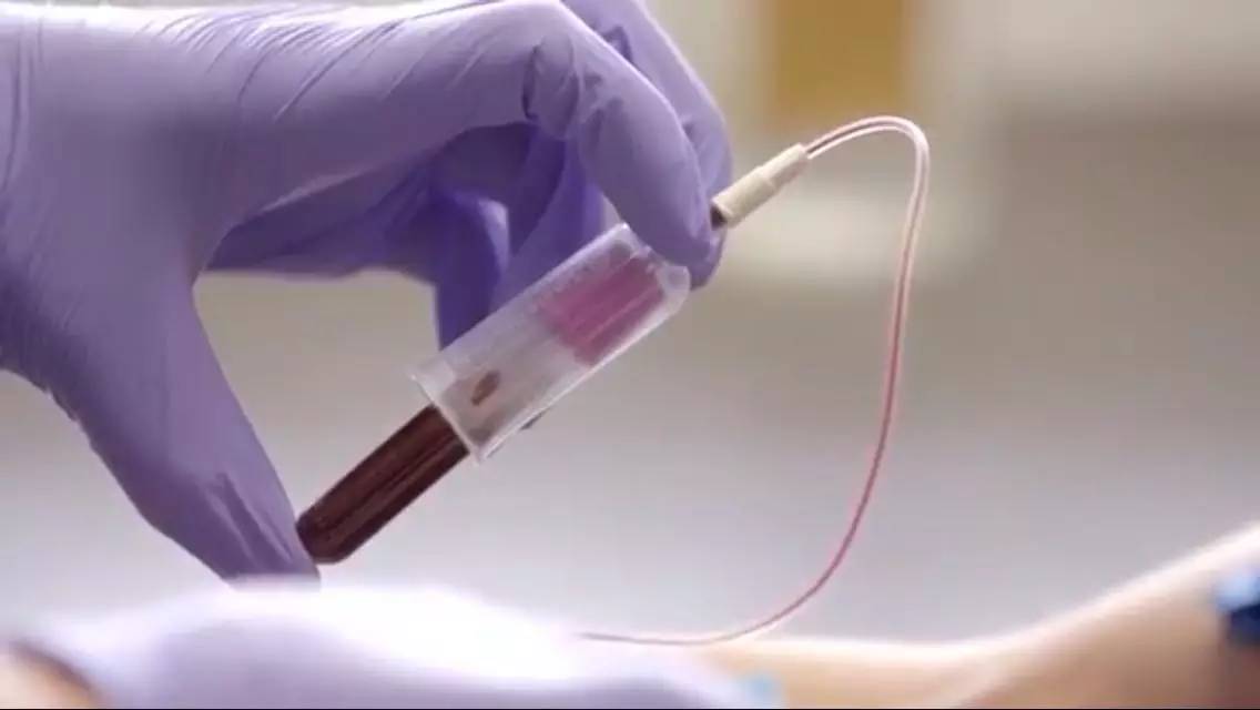 新款智能手机APP：用自拍筛查胰腺癌！