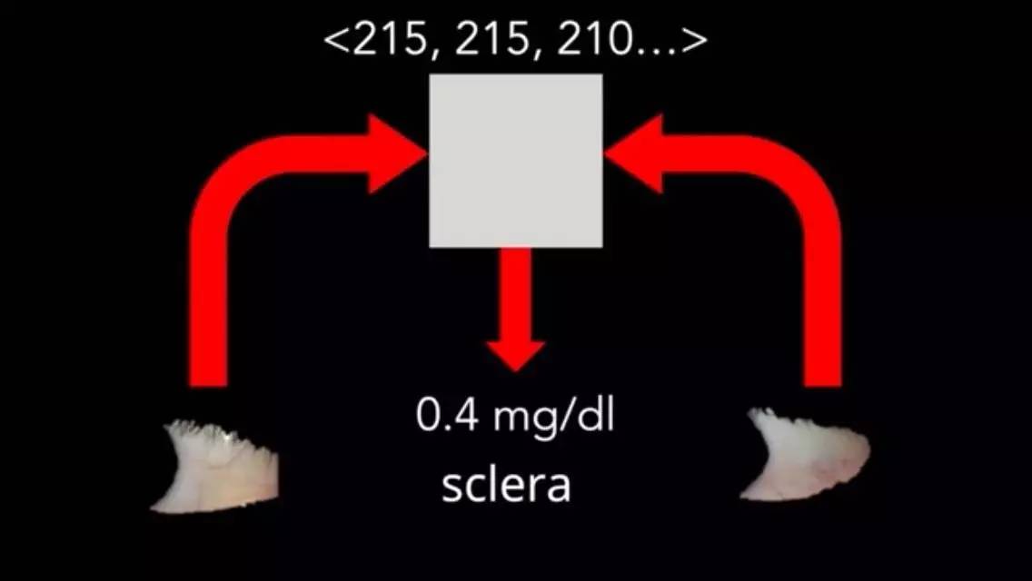 新款智能手机APP：用自拍筛查胰腺癌！