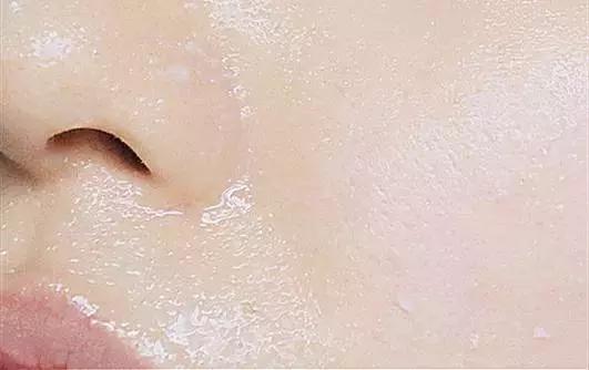 对待痘痘的正确心态,长痘如何正确对待