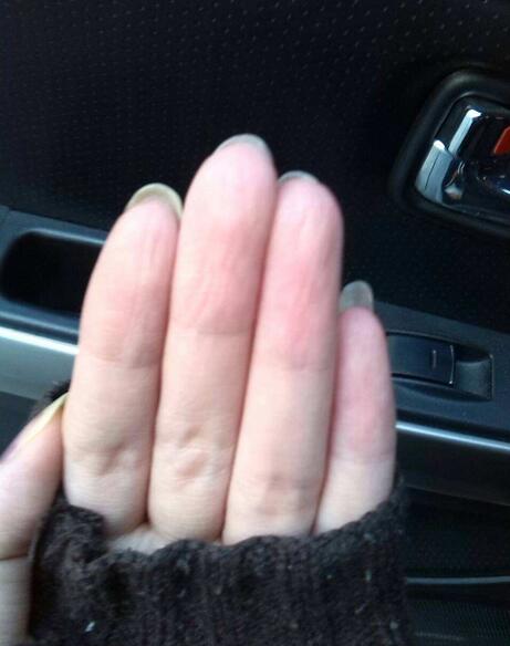 看双手就知道贫血与否！贫血只需补一种营养