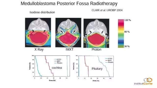 演讲PPT/法国居里研究所皮埃尔贝：儿童神经肿瘤的质子放疗