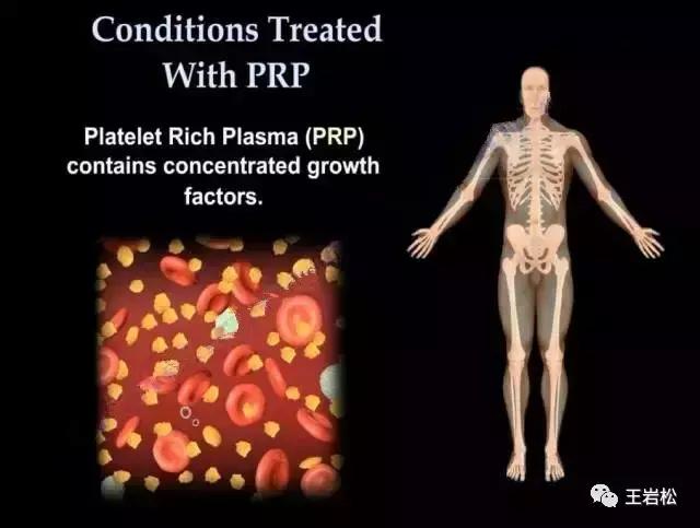 骨折术后怎么长得快,骨折为什么长得那么慢