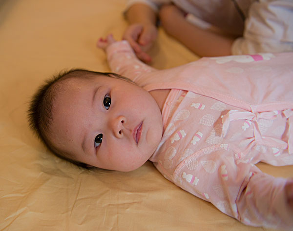 宝宝湿疹的最佳治疗方法干性湿疹,孩子湿疹反反复复怎么根除好