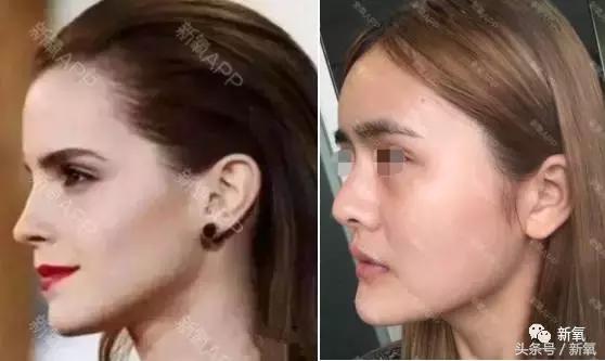 杨紫瘦了腿显得不纤细,杨紫变美之路脸怎么瘦的