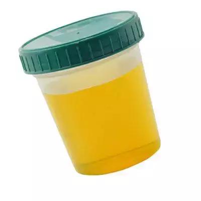 一泡尿就能看出你的肾好不好,第一泡尿如何看健康