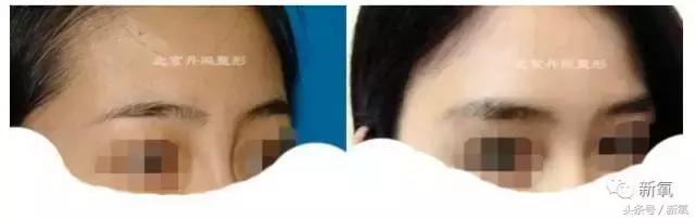 杨紫瘦了腿显得不纤细,杨紫变美之路脸怎么瘦的