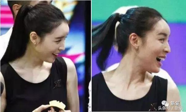 杨紫瘦了腿显得不纤细,杨紫变美之路脸怎么瘦的