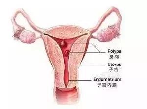 多年不孕的报应,多年不孕不育竟是妻子惹的祸