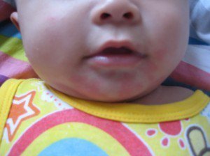 婴儿对牛奶过敏喝什么奶粉,宝宝奶粉过敏的识别和处理