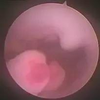 多年不孕的报应,多年不孕不育竟是妻子惹的祸