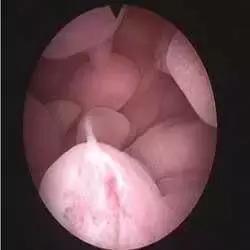 多年不孕的报应,多年不孕不育竟是妻子惹的祸