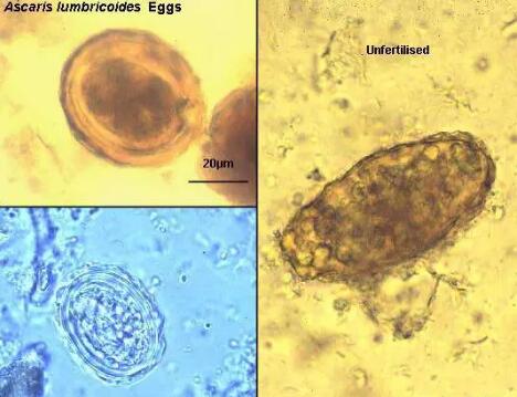 法斗寄生虫有哪些,法斗小肠寄生虫感染