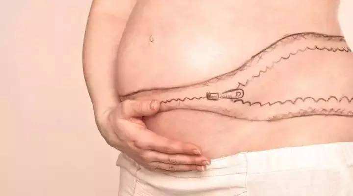 产后伤口已经恢复了还会疼怎么办,产后缓解伤口疼痛的方法