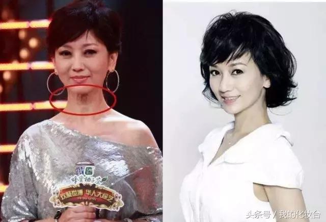 去天生颈纹的方法,颈纹多怎么锻炼