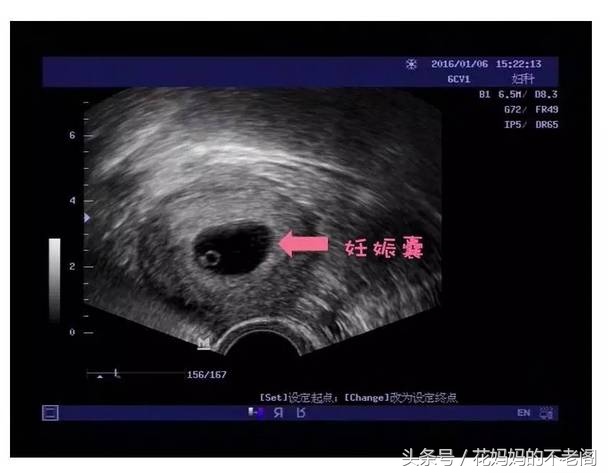 超全孕期产检攻略新手妈妈必备,最全孕期产检的项目及关注事项