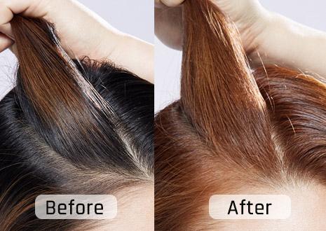 尴尬期后面的头发厚怎么办,发根尴尬期