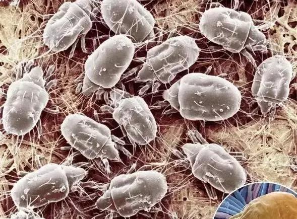 清除床单衣物的螨虫最好的方法,最全最有效去除家里的螨虫方法