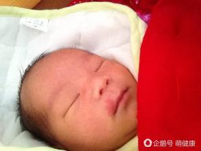 宝贝脸上红肿,宝宝脸上红斑疹子怎么办