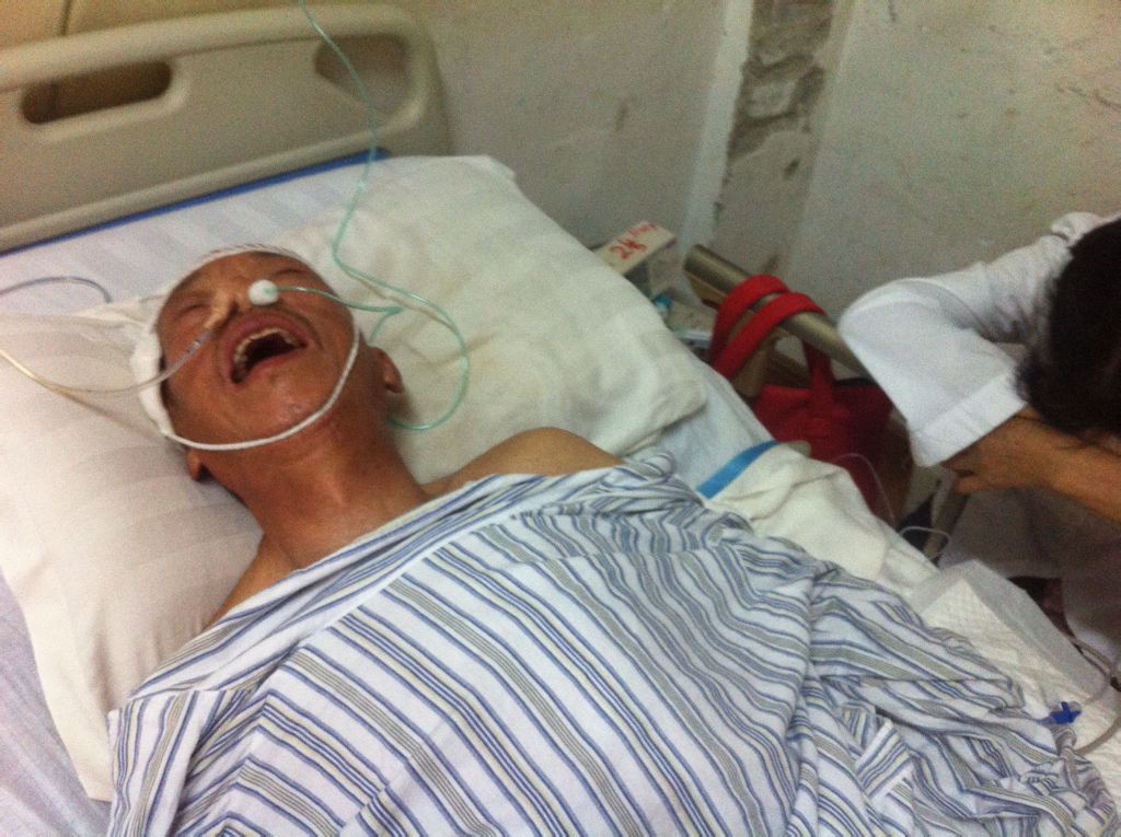 脑溢血后遗症,脑溢血后遗症针灸