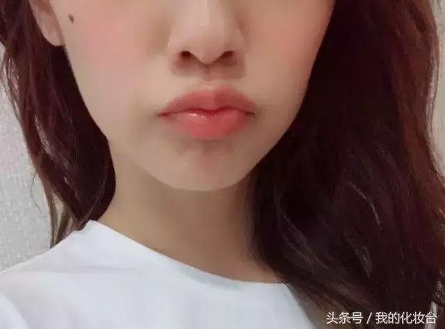 去天生颈纹的方法,颈纹多怎么锻炼