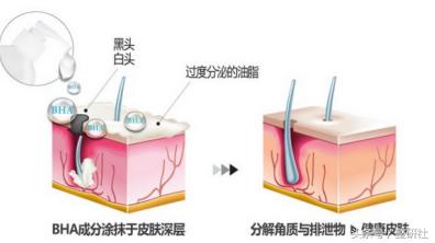 变美第一步就是清洁肌肤,美肌肌肤管理