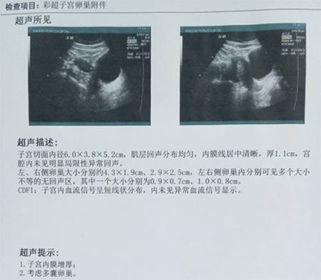 多囊中药调理多久才能怀孕,多囊怀孕生产后会好吗