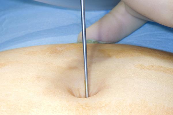 胸闷恶心头晕想吐乏力是怎么回事,胸闷恶心想吐是什么原因