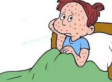 脸上长hpv扁平疣怎么预防,扁平疣怎样预防传染给别人