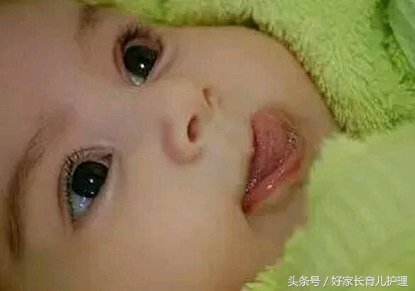 宝宝舌苔白需要吃药吗,宝宝舌苔白是积食没胃口