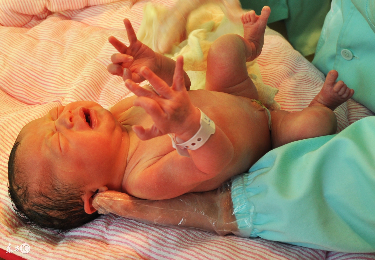 顺妇产和剖妇产差别,顺还是剖怎么听懂医生