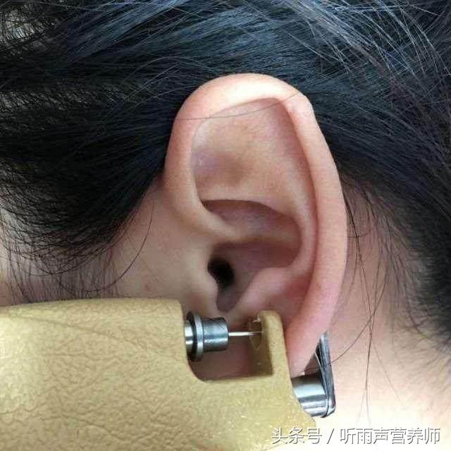 打完耳洞不能沾水,打完耳洞之后不能吃什么