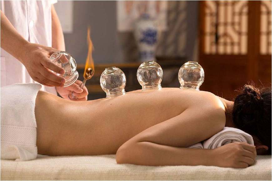 拔罐的好处和拔罐方法关注事项,拔罐慎重