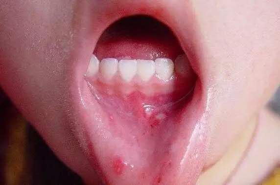 孩子逃避吃饭怎么办,孩子实在不想吃饭