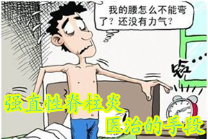 王振亮治疗强直性脊柱炎的手段,强直性脊柱炎有几种治疗方案