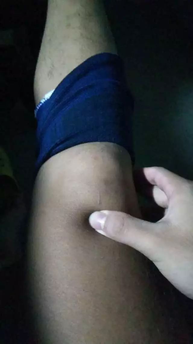 网球肘详细讲解,网球肘的最佳打法