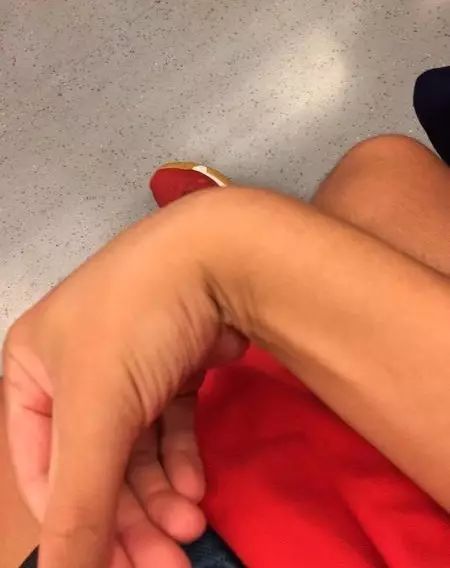 网球肘详细讲解,网球肘的最佳打法