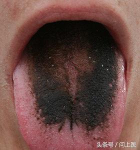 高能预警！图解13种不同寻常的药物副作用