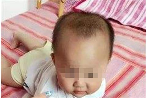 1岁来月经又来了怎么回事,孩子一个月反复来例假