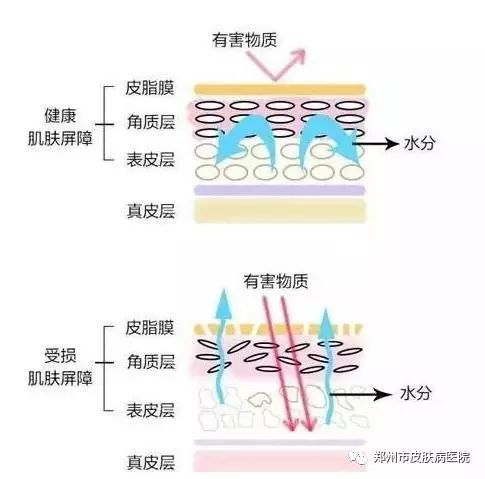 脸过敏发痒发红怎么治吃维生素b2,换季脸上过敏发红发痒补水有用吗