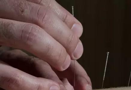 刘红云针灸退化性膝关节炎,膝关节炎的董氏针灸疗法