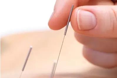 刘红云针灸退化性膝关节炎,膝关节炎的董氏针灸疗法