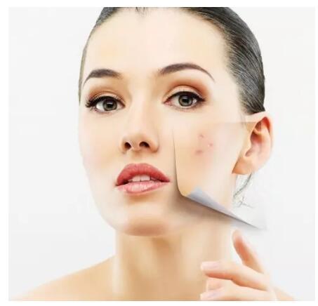 皮肤过敏大面积红肿起皮干痒紧绷,脸部泛红干燥起皮过敏发痒刺痛