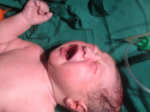 生宝宝先见红和先破羊水的区别,生孩子先破水还是先见红有讲究