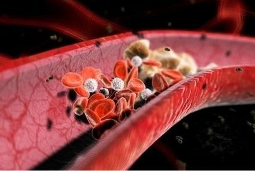 手脚经常发麻用什么药好,手脚麻木吃蜂蜜有好处吗