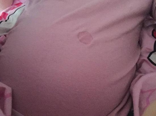 宝宝脐带刚掉脐窝是怎样的,一个多月婴儿脐带有黄水