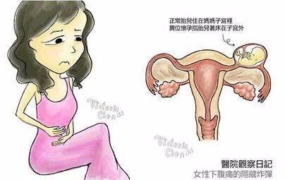 小柠老师分享-看看这些影响子宫健康的因素吧！