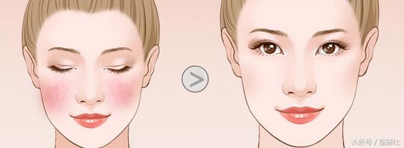 光电美肤美容项目,光电美肤效果怎么样