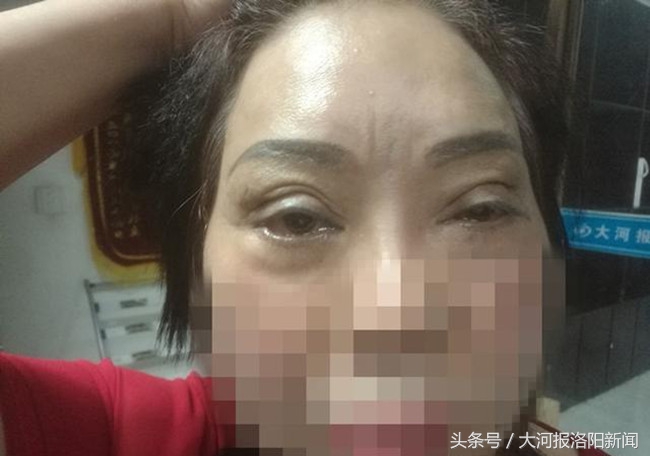 美容变毁容对方不赔偿怎么办,美容变毁容